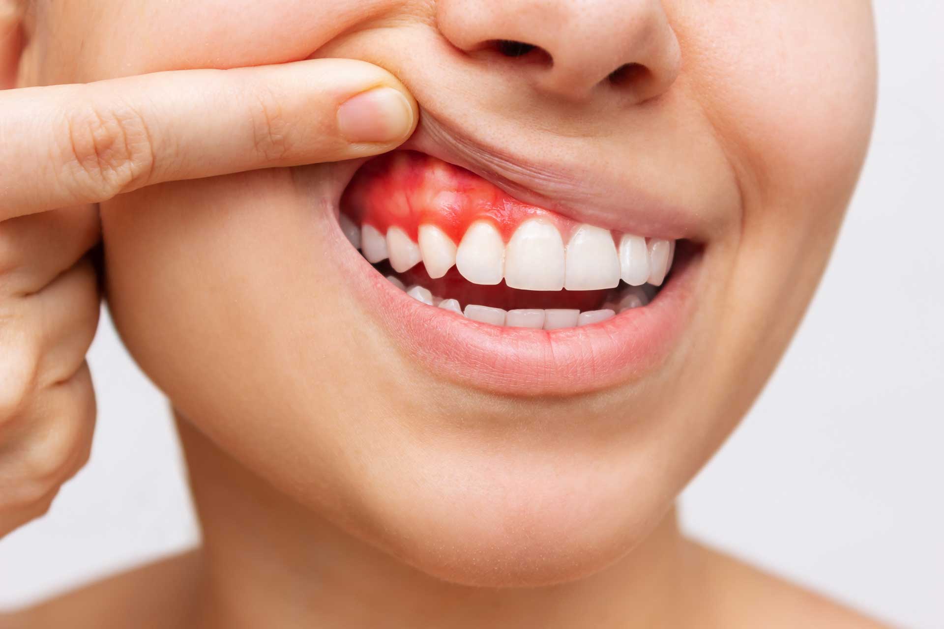 Factors That Harm Gum Health?