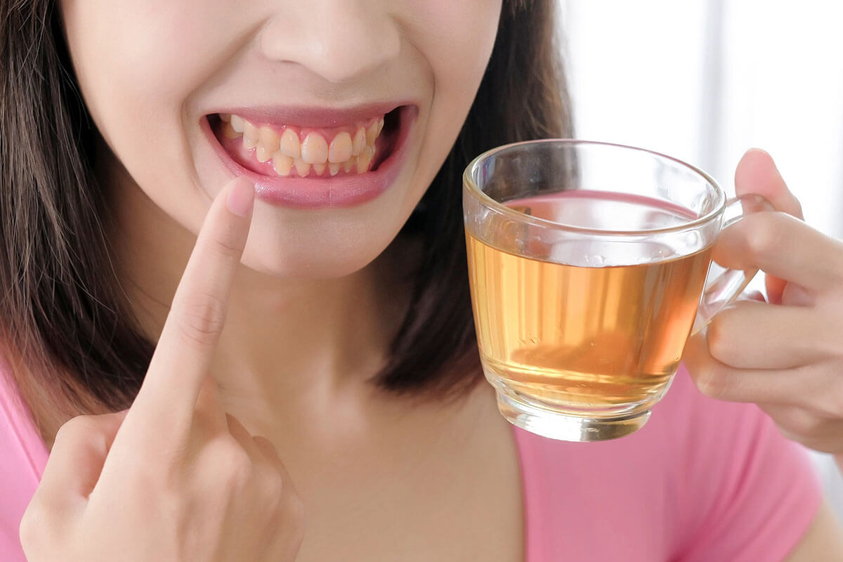 Foods and Drinks That Cause Tooth Staining