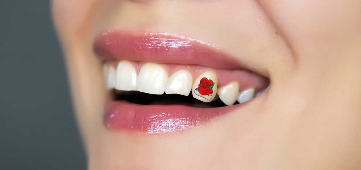 How is a Tooth Tattoo Done?