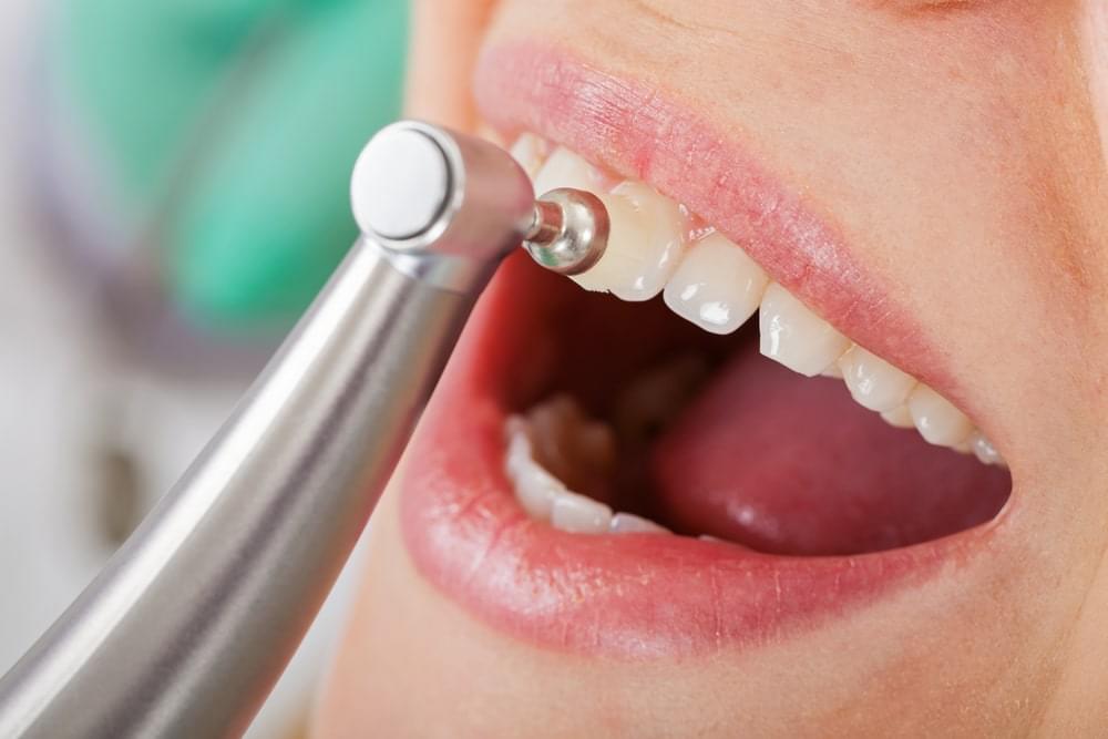Is It Harmful To Have Dental Cleaning?